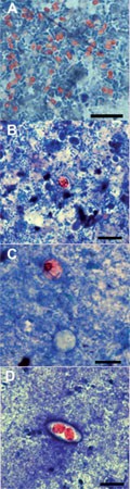 Mikroskopischer Nachweis der Erreger in Stuhlproben. E. cuniculi in der modifizierten Trichromfär-bung nach Weber (A), Cryptosporidien (B), Cyclospora (C) und Isospora (D) in der modifizierten Ziehl-Neelsen-Färbung. Balken = 10 µm. 