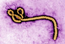 Abb.  EbolaVirus