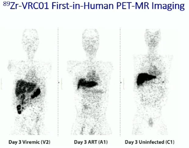 ZrVRC01-First-in-Human PET-MR imaging
