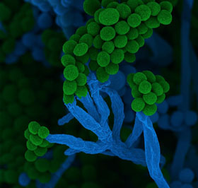 Die Mikrobe des Jahres 2026, Penicillium, ein Pinselschimmel, bildet charakteristische Zellketten mit Sporen am Ende. (Rasterelektronenmikroskopische Aufnahme, ca. 5000fach vergrößert, nachträglich eingefärbt.  Quelle: Ulrich Kück und Birgit Hoff  Copyright: Zur Verwendung im Zusammenhang mit der Pressemitteilung, CC BY4.0