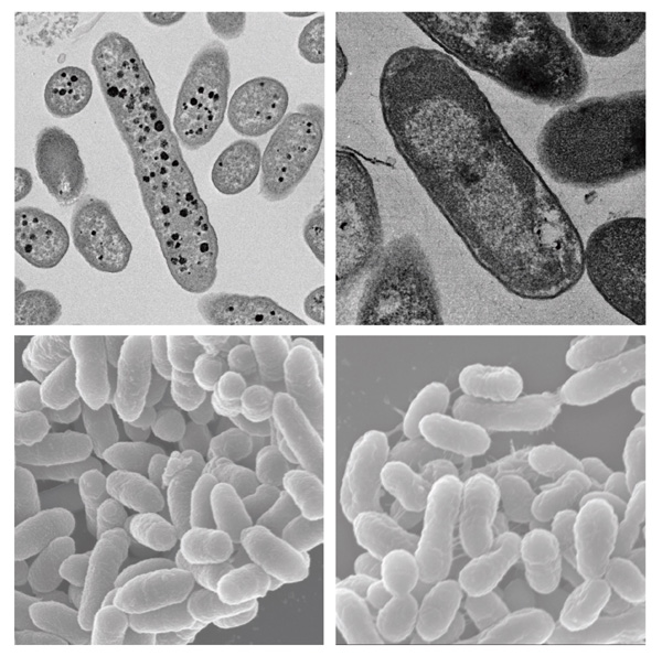 Bild Links: Bacteroides thetaiotaomicron , rechts: Akkermansia muciniphila Ç Tomonari Hamaguchi, Nagoya University