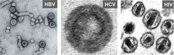 Abb. 1: Elektronenmikroskopische Aufnahmen von HBV, HCV und HIV-1 Partikeln (freundlicherweise zur Verfügung gestellt von Prof. S. Urban und S. Seitz (HBV), A. Merz (HCV) und Prof. H.-G. Kräusslich (HIV)) 