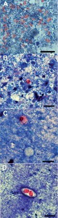 Mikroskopischer Nachweis der Erreger in Stuhlproben. E. cuniculi in der modifizierten Trichromfär-bung nach Weber (A), Cryptosporidien (B), Cyclospora (C) und Isospora (D) in der modifizierten Ziehl-Neelsen-Färbung. Balken = 10 µm.