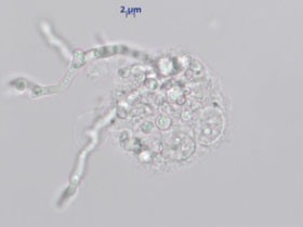 Abb. 2: Ebenfalls intrazelluläre Erregger in einer 4 Tage bei 26°C inkubierten Anreicherung (ungefärbt). Hier sind bereits auskeimende Pilzzellen erkennbar.