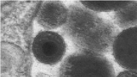 Abb. 1: CMV in einer humanen Fibroblastenzelle 