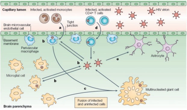 Abb. 1: HIV Neuroinvasion 1 