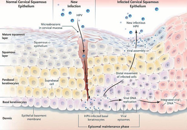 Abb. 1: Kahn J. N Eng J Med 2009; 361:271-278. HPV Lebenszyklus im Plattenepithel