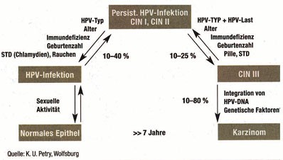 Abb. 2: Genese des Zervixkarzinoms