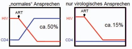 Abb 1 Unterschiede im immunologischen Ansprechen unter Initiierung von ART. Im „normalen“ Fall kommt es zum Abfall der Viruslast und zum Anstieg der CD4-Zellen. In ca. 15% zeigt sich ein immuno-virologisch diskordantes Ansprechen.14, 18, 20 