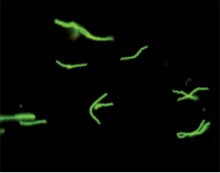 Abb. 6 Borrelien in der Immunfluoreszenz 