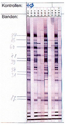 Westernblot