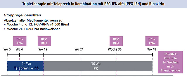 Abb. 5  Partielle Response und Null-Response in der Vortherapie, alle Patienten mit Zirrhose