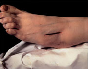 Andres Serrano, „The Morgue“ (Rat Poison Suicide II), 1992, Cibachrome, 125,73 cm x 152,4 cm