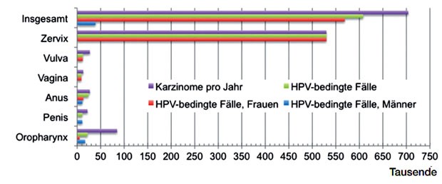 Abb. 1 Weltweite jährliche Anzahl und Verteilung HPV-bedingter Karzinome (Angaben für das  Jahr 2008 nach de Martel et al. Lancet Oncology 13, 2012).