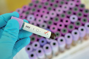 HIV-Test in Bayern