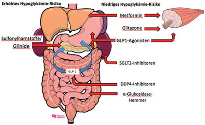 Abb. 1   Übersicht über die (Haupt-)Angriffspunkte der oralen Antidiabetika