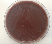 Abb. 2  Reinkultur Neisseria gonorrhoeae