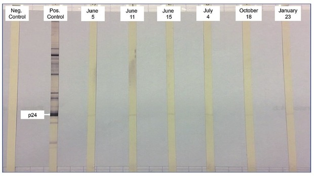 Abb. 3  HIV-ELISA im Verlauf