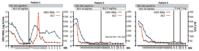 Abb 5  Langzeittherapie mit Bulevirtid bei Patienten mit kompensierter HDV-Zirrhose: Befunde  (Loglio A. EASL 2021. Abstr 1448)