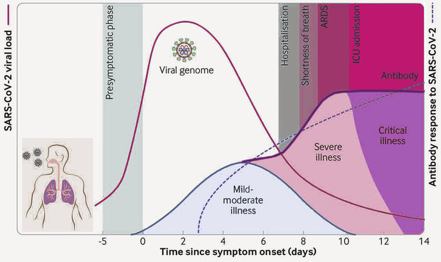 Abb. 1  Verlauf einer SARS-CoV-2 Infektion Quelle: EMA