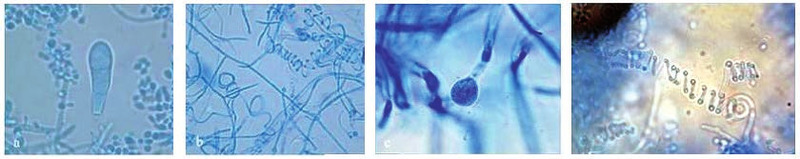 Abb. 2a-d: Mikroskopische Ansichten von T. mentagrophytes a) Makrobkonidie mit vielen runden Mikrokonidien b) Spiralhyphen c) Chlamydospore d) Spiralhyphe im Detai