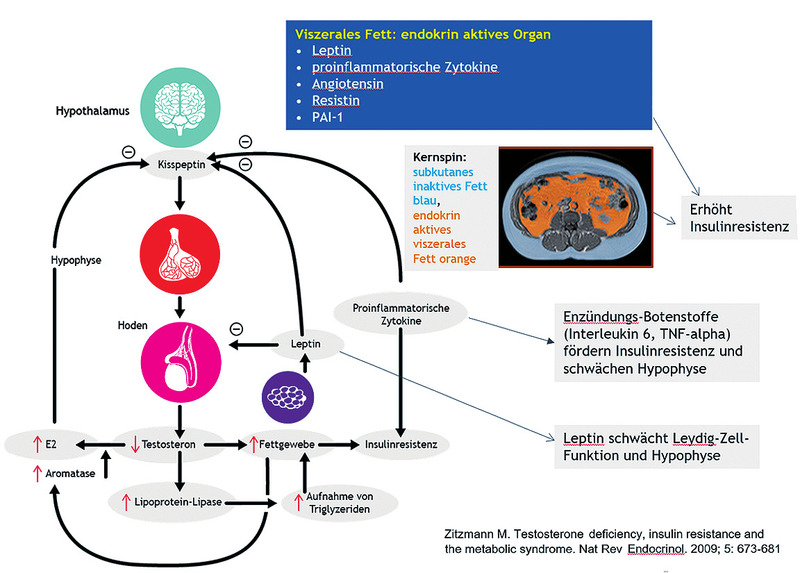 Abb. 1 Viszerales Fett und die hypothalamisch-hypophysär-gonadale Achse