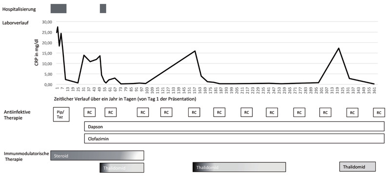 Abb. 4 Schematische Darstellung der ersten 365 Tage ab Erstvorstellung mit CRP- und Therapieverlauf; CRP: C-reactives Protein; R/C: Rifampicin/Clofazimin 1x/Monat; Pip/Taz: Piperacillin/Tazobacta