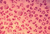Abb. 1  Gram-gefärbte Neisseria gonorrhoeae aus einem Harnröhrenabstrich