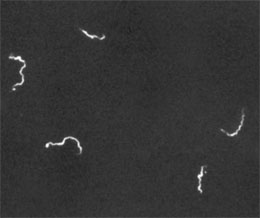 Abb. 6  Treponema pallidum in der Dunkelfeldmikroskopie, gefärbt mittels Immunfluoreszenz-Technik Quelle: ©CDC/C.W. Hubbard