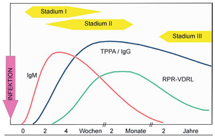 Abb. 8  Serologischer Verlauf der Syphilis